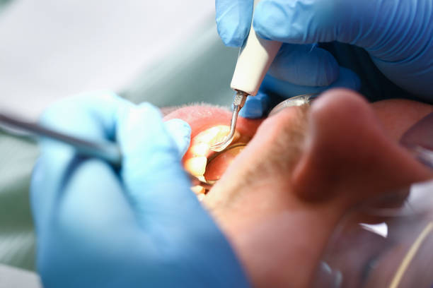 Best Root Canal Emergency Dentist  in Comfort, TX