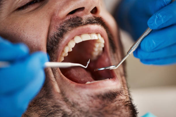 Best Broken Tooth Emergency  in Comfort, TX