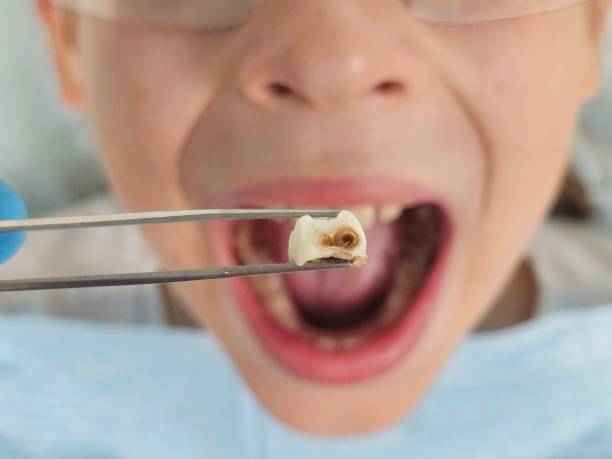 Best Dentist for Severe Toothache  in Comfort, TX