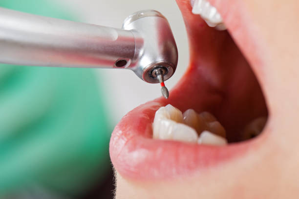 Best Tooth Infection Emergency Dentist  in Comfort, TX